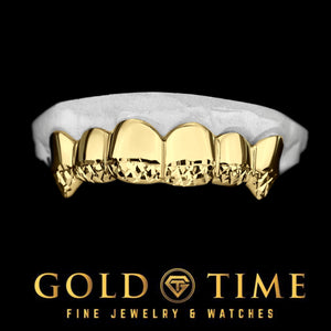 Yellow gold six piece trillion cut tip grillz seated on a white dental model