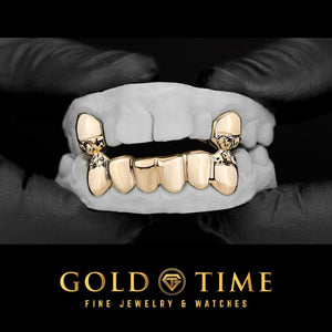 8 piece gold grillz set with solid canines and trillion diamond-cut tips held on a dental mold