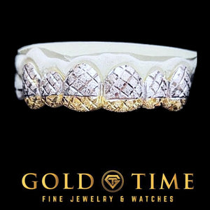 Custom 6 piece two-tone grillz with white trillion diamond-cut faces and textured yellow tips, on an upper dental mold