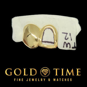 Yellow gold double cap with a diamond-cut solid canine and polished open face incisor on a labeled dental mold
