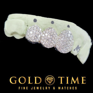 Three piece honeycomb bustdown grillz fully covered in handset moissanite, shown on a dental mold