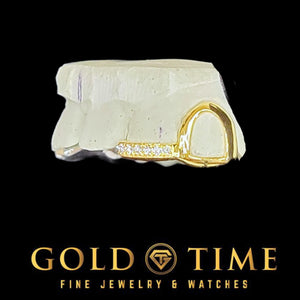 Single yellow gold open face cap fitted to a dental mold