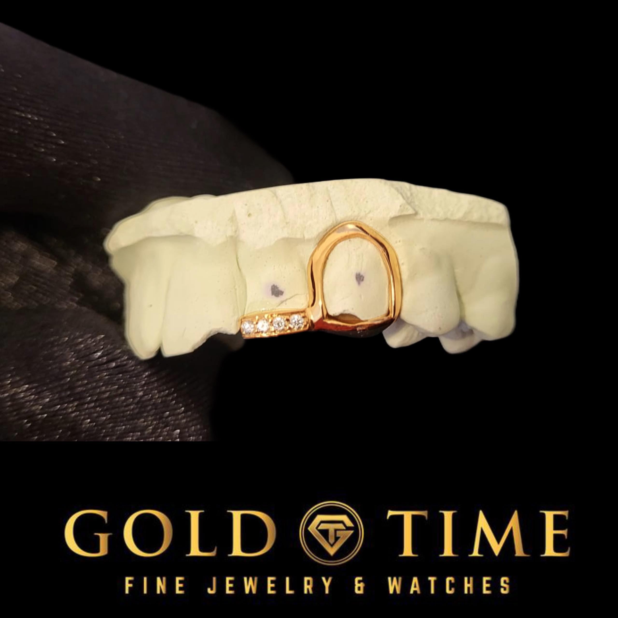 Custom Grillz: Open Face Canine & Moissanite Tip - Handmade Fit, Impression Kit