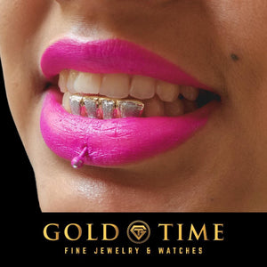 Woman with pink lipstick smiling in a two-tone diamond dust box grill