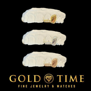 Solid canine and moissanite tip double cap grillz shown in yellow, white and rose finishes