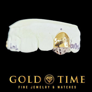 Close view of a single gold tooth cap with a white trillion cut tip fitted on a dental model