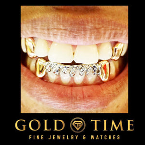 Close-up of a person wearing two-tone grillz with yellow fangs and a white drip bottom