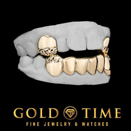Custom 8 piece gold grillz set with 2 solid top canines and 6 solid bottom teeth with diamond-cut tips on a dental mold