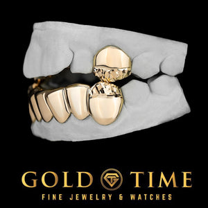 Side view of 8 piece gold grillz with solid top canines and bottom six with diamond-cut tips