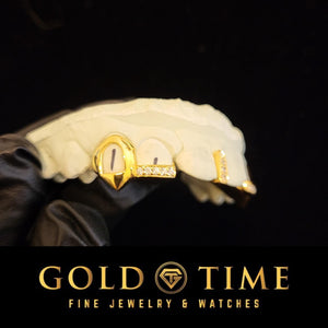 Gold open face fang grillz held in a gloved hand on a dental model against black