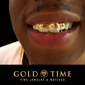 Diamond dust canine grillz worn
