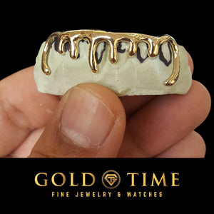 Hand holding custom yellow gold drip grillz on a mold