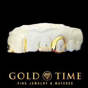 Yellow gold open face canine and moissanite tip grillz on a dental mold, black background, Gold Time