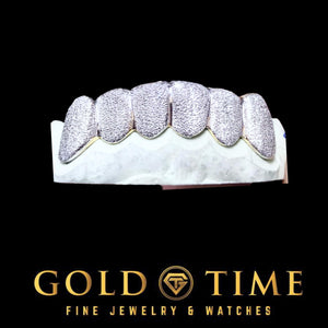 White metal 6 piece diamond dust grillz with a thin polished rim on a dental mold, Gold Time