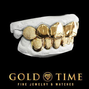 Angled view of the 12 piece gold perm cut grillz set showing the diamond dust texture against the polished solid teeth