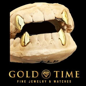 Yellow gold solid fang caps on the upper and lower canines of a full dental model with the mouth open, Gold Time