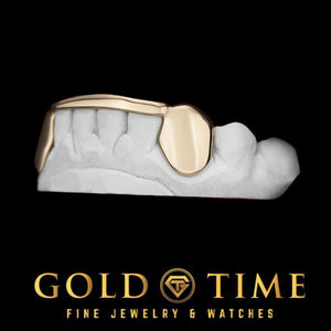 Side view of 6 piece gold grillz with a solid canine cap and center tip bar on a mold