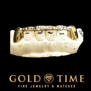 Front view of yellow gold solid canines with a trillion tip bar