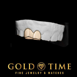 Two solid yellow gold double caps fitted to a dental mold