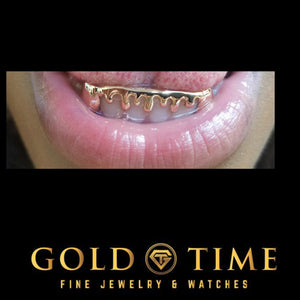 Smile wearing custom yellow gold drip grillz