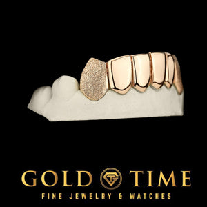 Left angle of the six piece grill showing a pointed diamond dust canine fang