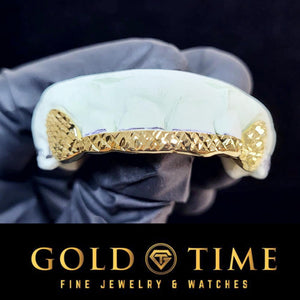 Custom 6 piece yellow gold trillion cut grillz on a mold