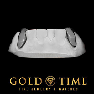 Angled view of the two black canine caps and the connecting bar on a dental model