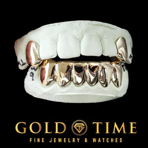 Silver solid top canine caps with a solid bottom six grillz set on dental molds