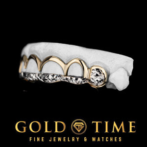 Two tone open face grillz seated on a white dental model, front view