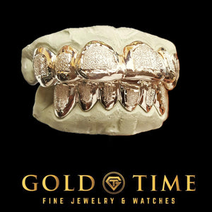 Top and bottom diamond dust box grillz with gold frames on dental molds, custom color example