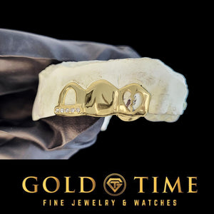 Yellow triple cap grillz on a dental mold held in a gloved hand, with the moissanite tip, solid canine, and broken heart cut-out