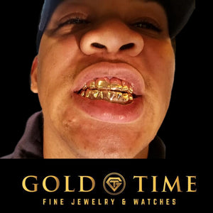Customer wearing yellow gold solid perm cut grillz on top and bottom teeth
