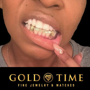 Customer wearing custom trillion cut grillz