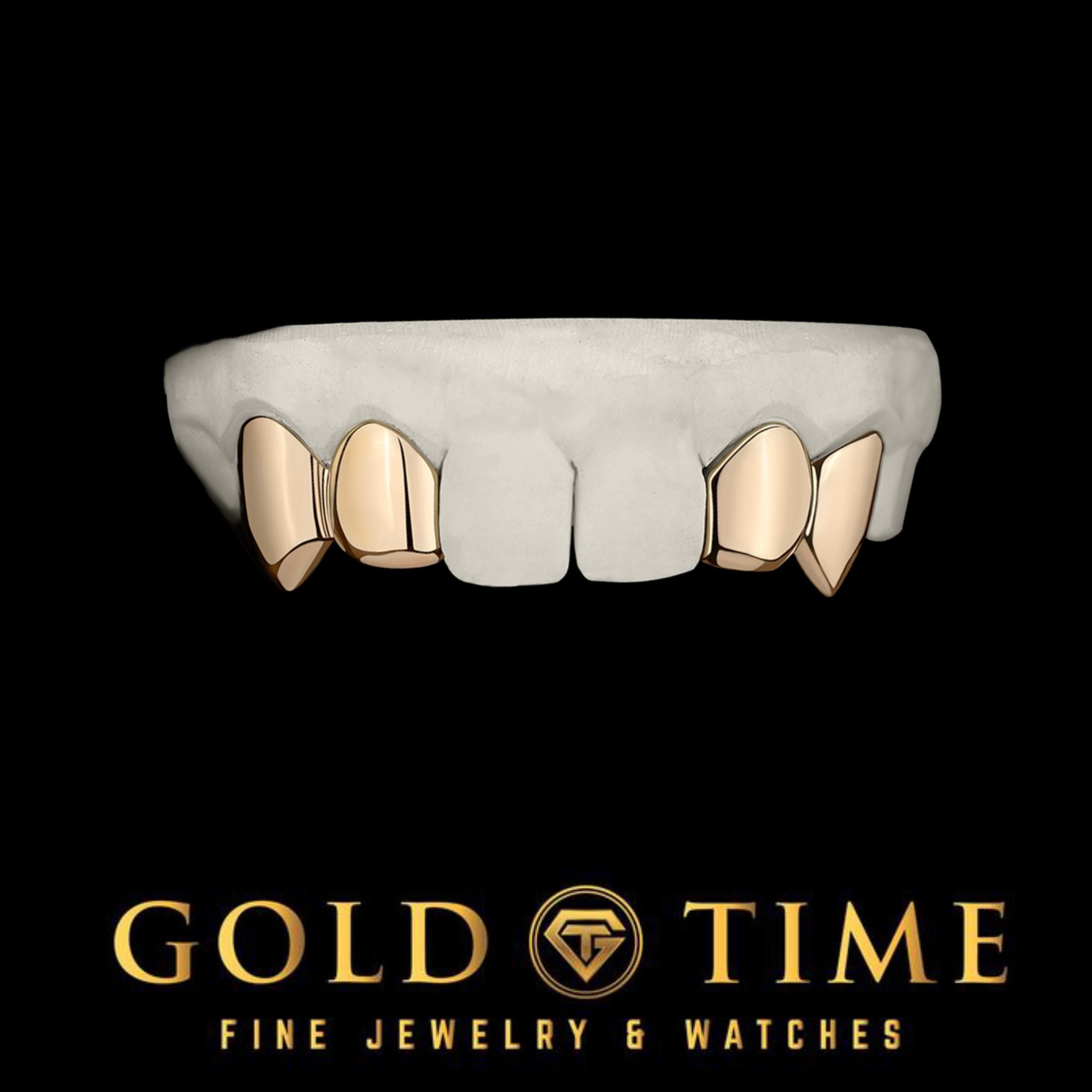 Custom 4 Piece Solid Incisor and Fang Grillz - Custom Fit Gold or Silver Grillz - Includes Mold Kit - Made to Order Teeth Jewelry