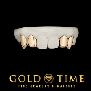 Rose gold 4 piece solid grillz with lateral incisor caps and canine fangs, central incisors bare, on a dental mold, Gold Time
