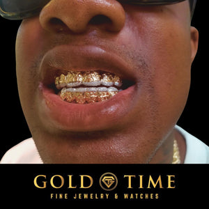 Man wearing top and bottom custom nugget diamond dust grillz