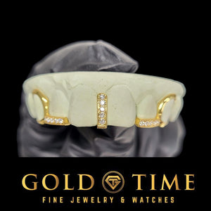 Yellow gold 5 piece grillz with a moissanite gap bar and open face canines on a dental mold, Gold Time