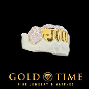 Side view of yellow gold grillz with diamond dust canines