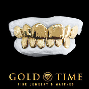 Custom 12 piece gold grillz set on dental molds with perm cuts, solid classic front teeth, diamond dust canines, and a box-design bottom with dust interiors, Gold Time