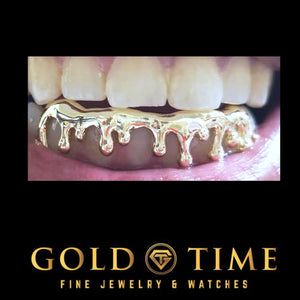 Close up of custom yellow gold drip grillz worn