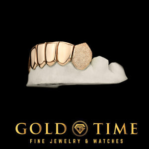 Right angle of the six piece grill showing a diamond dust canine fang and perm cuts