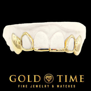 Custom 6 piece yellow gold grillz with a solid tip bar, open face laterals and solid canines on a dental mold, Gold Time