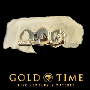 Yellow triple cap grillz on a dental mold, showing the moissanite lined tip beside the solid canine and broken heart cut-out