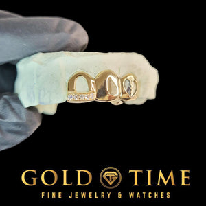 Yellow triple cap grillz on a dental mold held in a gloved hand, angled to show the solid canine and broken heart cut-out