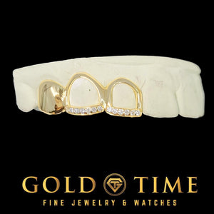 Custom yellow gold triple cap grillz, 1 solid cap and 2 open face caps with moissanite tips