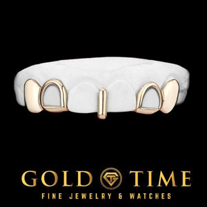 Rose gold 5 piece grillz with solid canines, open face incisors and a solid gap bar