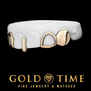 Side view of rose gold open face incisor and solid canine grillz with gap bar