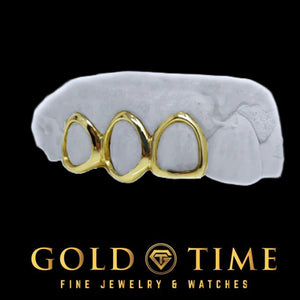 Yellow gold open face triple cap grillz on a white dental mold, black background, Gold Time