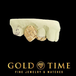 Side view of gold diamond-cut fang caps on a dental mold