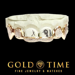 Rose gold six piece grillz with diamond dust windows, front tips and pointed canine fangs on a dental model